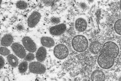 FILE - This 2003 electron microscope image made available by the Centers for Disease Control and Prevention shows mature, oval-shaped monkeypox virions, left, and spherical immature virions, right, obtained from a sample of human skin associated with the 2003 prairie dog outbreak. British health officials said Monday, June 13, 2022 they have detected another 104 cases of monkeypox in England, in what has become the biggest outbreak beyond Africa of the normally rare disease.  (Cynthia S. Goldsmith, Russell Regner/CDC via AP, file)