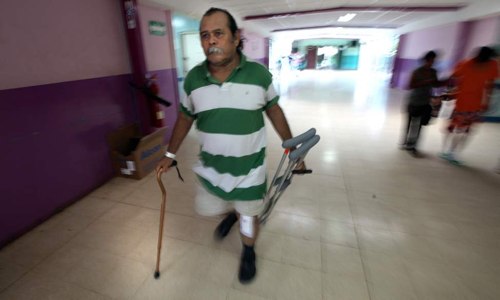 Using a single cane and carrying his crutches Juan Canda leaves the hospital in Managua for home four days after