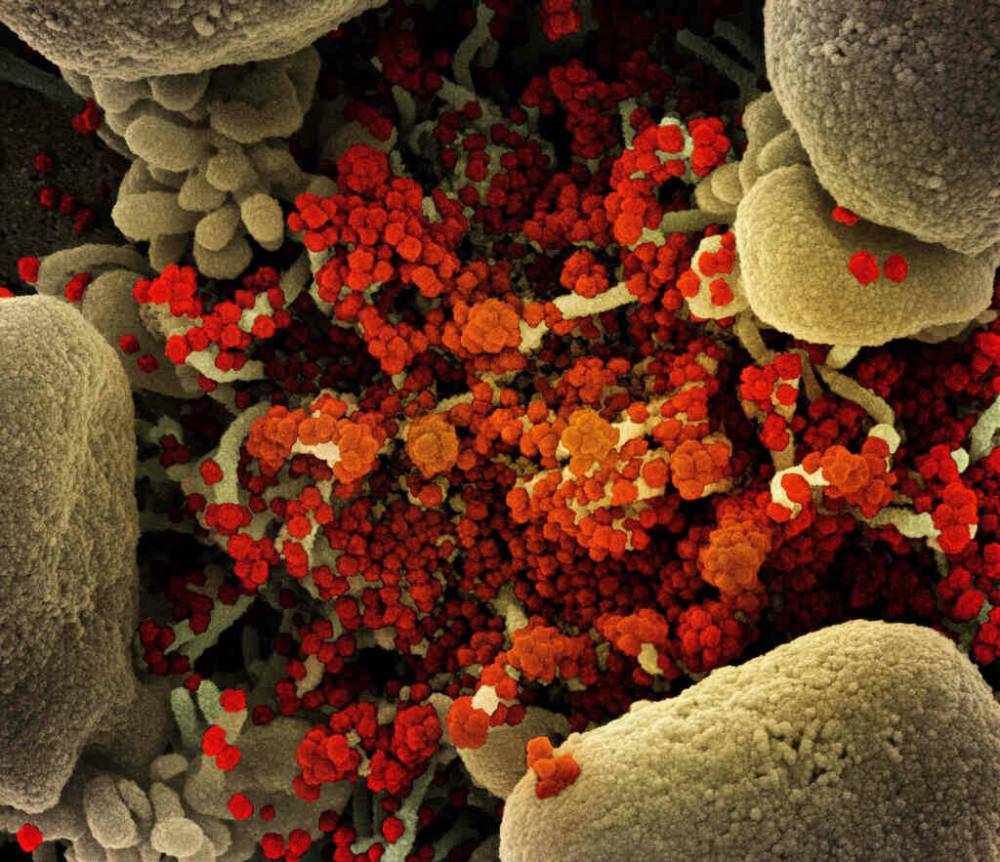NIAID VIA ZUMA WIRE/TNS
A new study of blood tests suggests between 50 and 60 per cent of Canadians in western and central provinces, including Manitoba, had been infected with the novel coronavirus by the end of May.