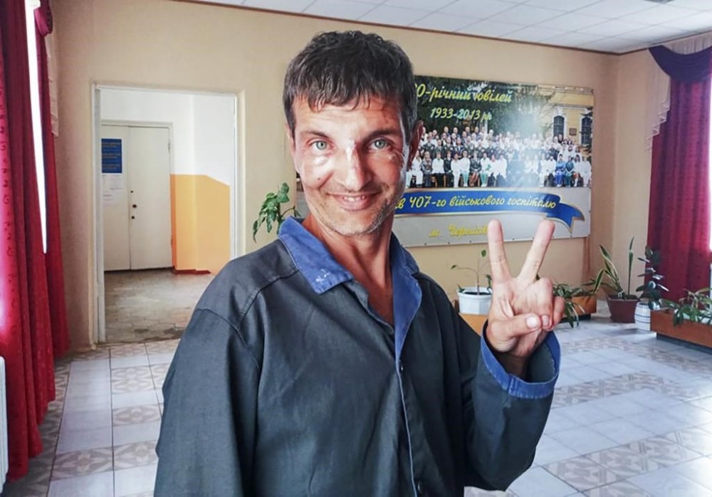 Ukrainian soldier Mykhailo Dianov, who was released in a prisoner exchange between Russia and Ukraine shows a V-sign in a city hospital in Chernihiv, Ukraine,Thursday, Sept. 22, 2022. Ukraine announced a high-profile prisoner swap early Thursday that culminated months of efforts to free many of the Ukrainian fighters who defended a steel plant in Mariupol during a long Russian siege. (AP Photo/Iryna Timofeeva)