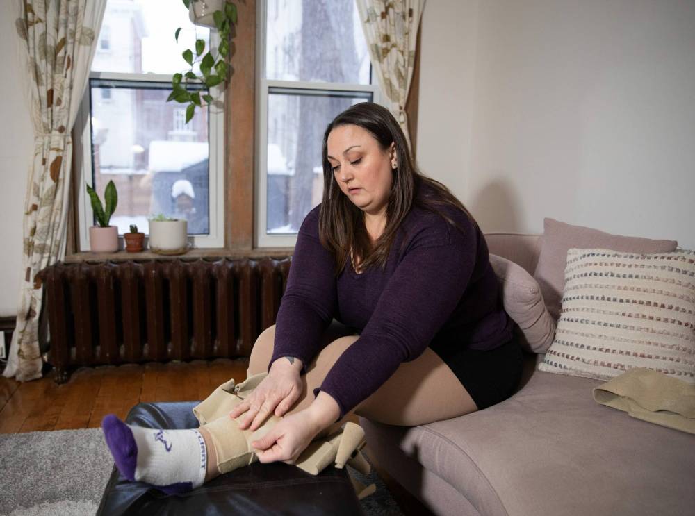 Emma Cloney, 38, suffers from lipedema, a debilitating condition which causes excess fat growth and must wrap herself with bandages every day to manage symptoms. (Jessica Lee / Winnipeg Free Press)