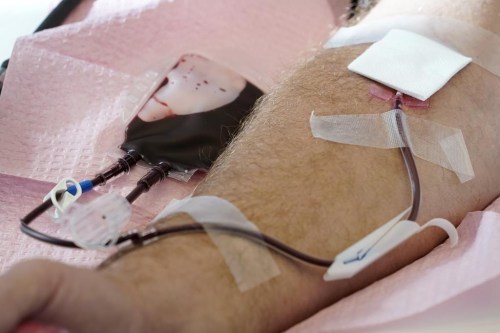 FILE - Tubes direct blood from a donor into a bag in Davenport, Iowa, on Friday, Nov. 11, 2022. The U.S. is moving to ease restrictions on blood donations from gay and bisexual men and other groups that traditionally face higher risks of HIV. The Food and Drug Administration on Friday, Jan. 27, 2023, announced draft guidelines that would do away with the current three-month abstinence requirement for donations from men who have sex with men. (AP Photo/Charlie Neibergall, File)