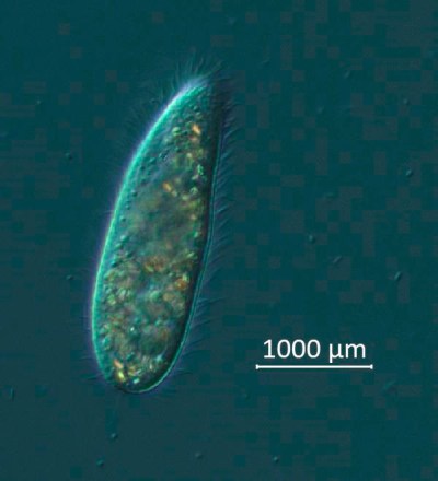 This photo provided by researchers shows a Philaster apodigitiformis ciliate microorganism viewed under the microscope at the University of South Florida College of Marine Science in St. Petersburg, Fla. The measurement scale of 1000 micrometers is equal to 1 millimeter. The tiny single-celled organism is to blame for a massive die-off of sea urchins in the Caribbean in 2022, researchers reported Wednesday, April 19, 2023, in the journalScience Advances. (Mya Breitbart/University of South Florida College of Marine Science via AP)