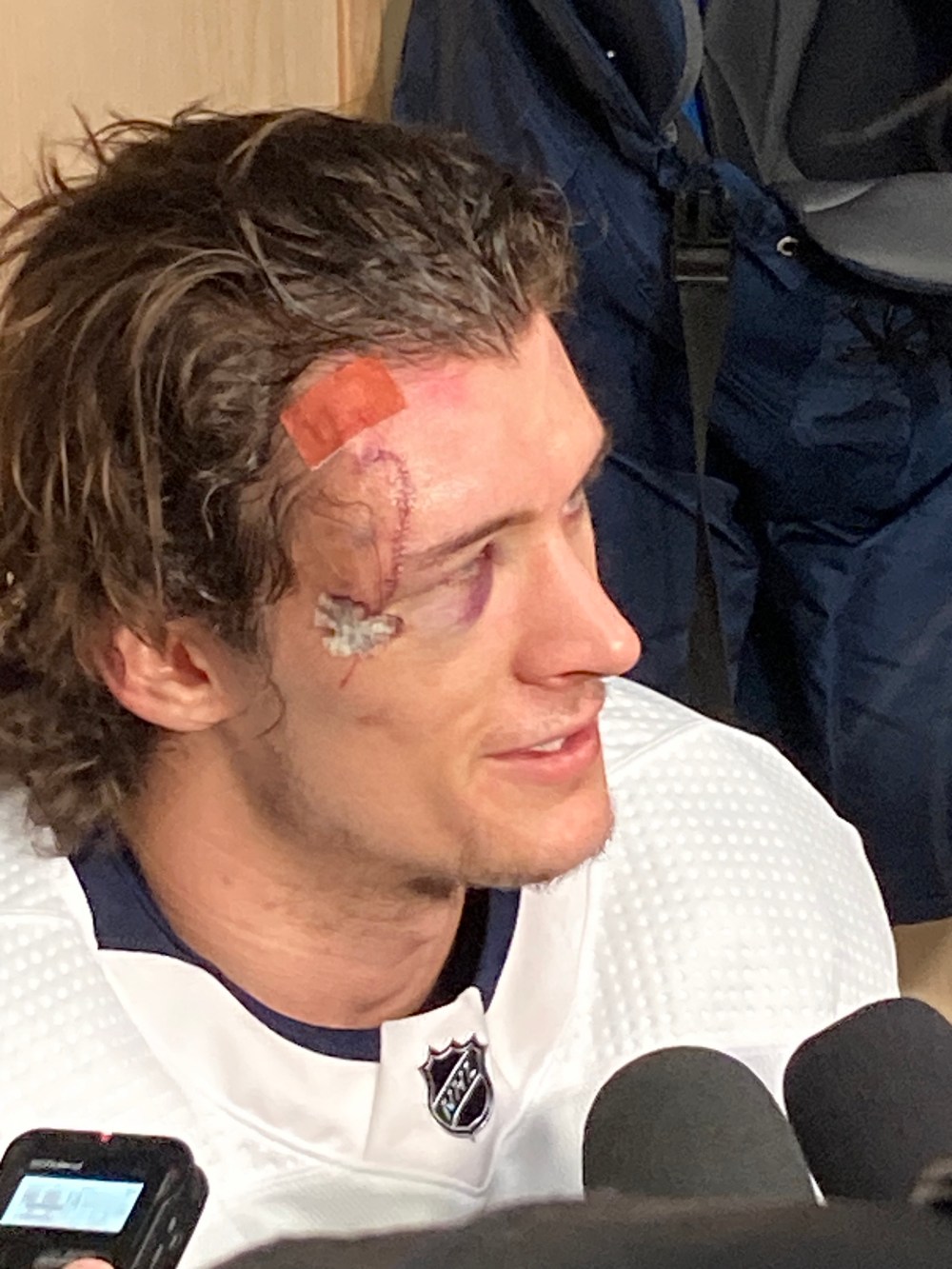 Morgan Barron got 75 stitches above his eye after falling onto the skate of Vegas goalie Laurent Brossoit (Mike McIntyre / Winnipeg Free Press)