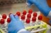 FILE - In this Wednesday, March 11, 2020 file photo, a technician prepares COVID-19 coronavirus patient samples for testing at a laboratory in New York's Long Island. Confidence in the scientific community declined among U.S. adults in 2022, a major survey shows, driven by a a partisan divide that emerged during the COVID-19 pandemic. (AP Photo/John Minchillo, File)