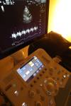 TREVOR HAGAN / WINNIPEG FREE PRESS Echocardiogram machine at Prota Clinic, Wednesday, December 27, 2017.
