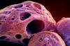 NIAID-NIH / THE CANADIAN PRESS
                                Manitoba has detected an unknown number of cases of the latest Omicron subvariant, EG.5, of COVID-19 that has become dominant in the United States. A colorized electron microscope image, in November 2022, shows cells, indicated in purple, infected with the omicron strain of the SARS-CoV-2 virus, orange, isolated from a patient sample.