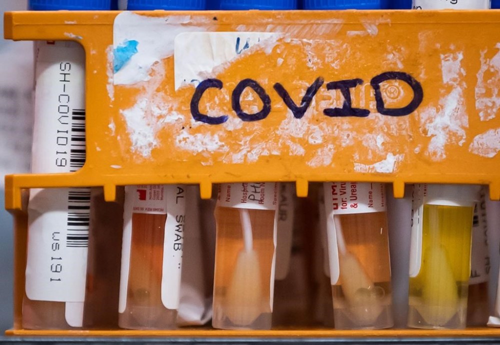 Specimens to be tested for COVID-19 are seen in Surrey, B.C., on Thursday, March 26, 2020. New data from the Public Health Agency of Canada suggests that COVID-19 infections may be slowly starting to rise again in Canada. THE CANADIAN PRESS/Darryl Dyck
