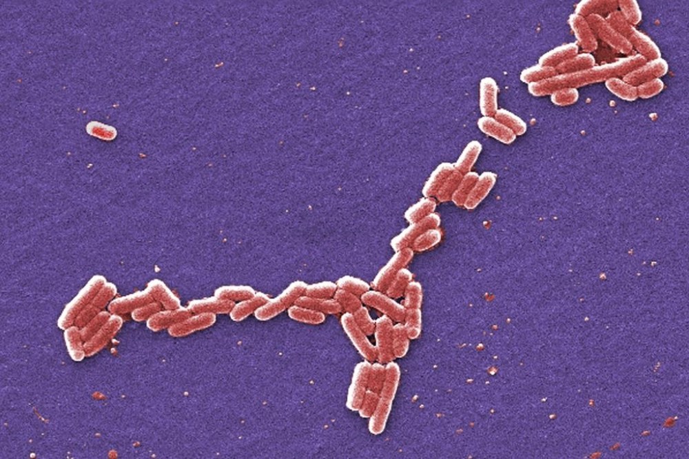Alberta Health Services says up to 50 children have arrived at hospitals in connection with an E. coli outbreak that's been declared at six locations of a Calgary daycare operator. E. coli bacteria of the O157:H7 strain that produces a powerful toxin which can cause illness is seen in a 2006 handout colorized scanning electron microscope image. THE CANADIAN PRESS/AP-HO, Centers for Disease Control and Prevention, Janice Haney Carr, *MANDATORY CREDIT*