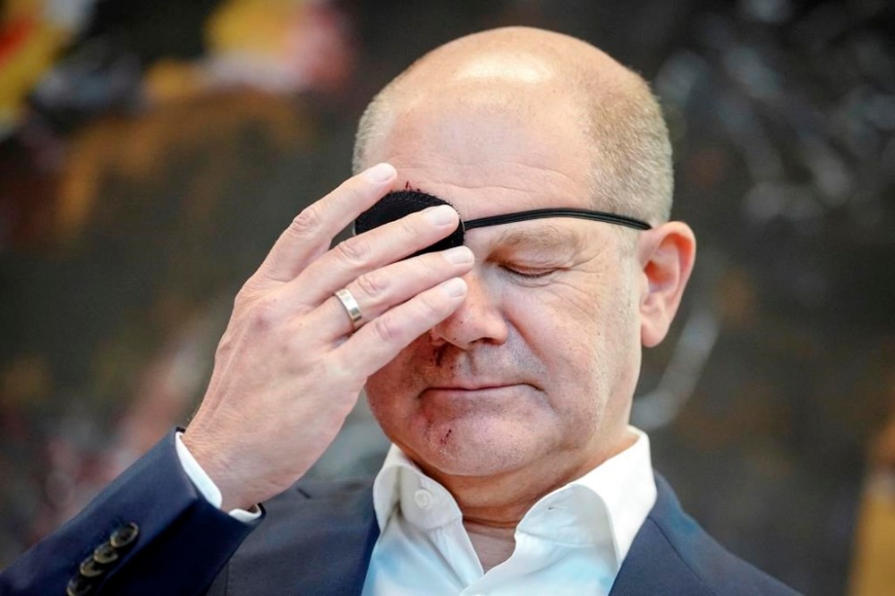 German Chancellor Scholz tweets picture of himself with black eye patch ...