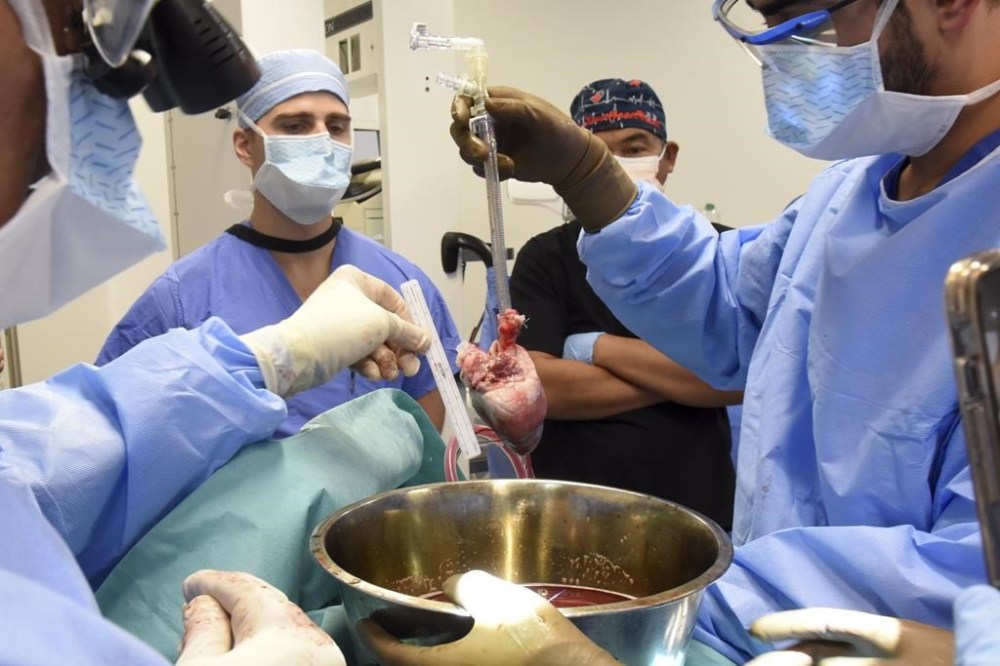 In this photo provided by the University of Maryland School of Medicine, surgeons prepare for a pig heart transplant into Lawrence Faucette at the school's hospital in Baltimore, Md., in September 2023. Two days after the transplant, Faucette was cracking jokes and able to sit in a chair, doctors said Friday, Sept. 22, 2023. (Deborah Kotz/University of Maryland School of Medicine via AP)