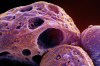 New data suggest that COVID-19 activity in British Columbia continues to decrease, while influenza and RSV are on the rise. This colourized electron microscope image made available by the National Institute of Allergy and Infectious Diseases in November 2022, shows cells, indicated in purple, infected with the omicron strain of the SARS-CoV-2 virus, orange, isolated from a patient sample, captured at the NIAID Integrated Research Facility (IRF) in Fort Detrick, Md. THE CANADIAN PRESS/AP-HO, NIAID/NIH