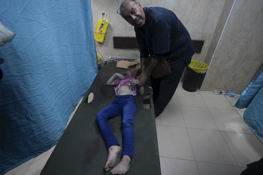 A Palestinian child wounded in the Israeli bombardment of the Gaza Strip is brought to a treatment room of al Aqsa Hospital on Deir al Balah, Gaza Strip, Sunday, Nov. 19, 2023. (AP Photo/Adel Hana)