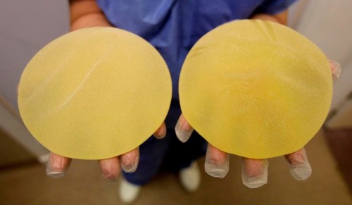 A nurse holds defective breast implants in Nice, southern France, Tuesday, Jan. 10, 2012. In Canada, the House of Commons health committee is echoing long-standing calls from plastic surgeons and patient advocates for a national breast implant registry to prevent illness and problems linked to the medical devices. THE CANADIAN PRESS/AP-Lionel Cironneau