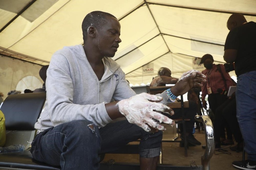 Residents who suffered burns following a fire caused by a vehicle loaded with gas which exploded, receive treatment at Mama Lucy Hospital in Nairobi, Kenya, Friday, Feb. 2, 2024. The truck explosion ignited a huge fireball, and a flying gas cylinder set off a fire that burned down the Oriental Godown, a warehouse that deals with garments and textiles, according to government spokesman Isaac Mwaura. (AP Photo)