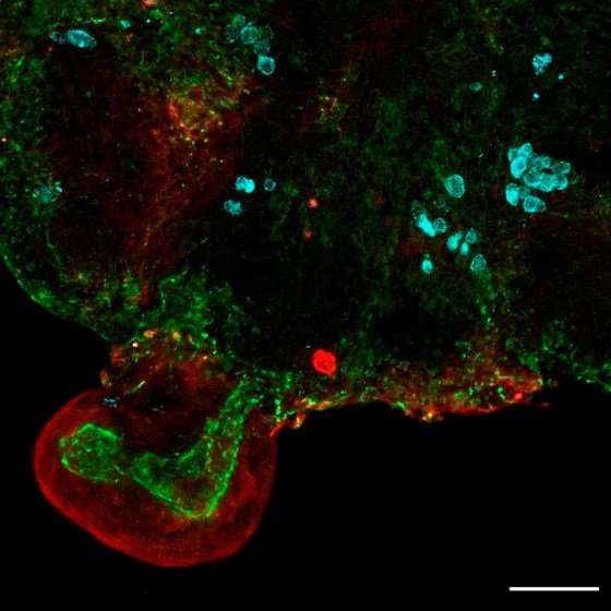 This microscope image shows an intestinal organoid with its distinctive 'bud' structure, created from cells collected from amniotic fluid. (Giuseppe Calà, Paolo De Coppi, Mattia Gerli via The Associated Press)