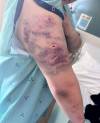 SUPPLIED
                                A woman, 22, was mauled by six dogs on Waywayseecappo First Nation, located more than 300 kilometres northwest of Winnipeg.