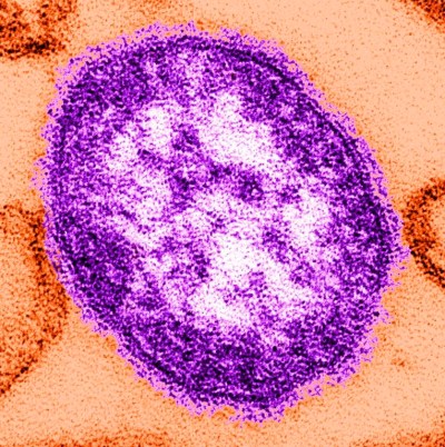 FILE - This undated image made available by the Centers for Disease Control and Prevention on Feb. 4, 2015, shows an electron microscope image of a measles virus particle, center. A West Virginia hospital has identified the first case of measles in the state since 2009, health officials said Monday, April 22, 2024. (Cynthia Goldsmith/Centers for Disease Control and Prevention via AP, File)