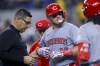 Cincinnati Reds' Tyler Stephenson, center, has his hand inspected after he was hit by a pitch during the seventh inning of a baseball game against the Texas Rangers in Arlington, Texas, Saturday, April 27, 2024. (AP Photo/Gareth Patterson)
