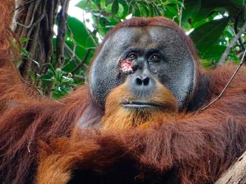 This photo provided by the Suaq foundation shows a facial wound on Rakus, a wild male Sumatran orangutan in Gunung Leuser National Park, Indonesia, on June 23, 2022, two days before he applied chewed leaves from a plant, used throughout Southeast Asia to treat pain and inflammation and to kill bacteria, to the wound. (Armas/Suaq foundation via AP)