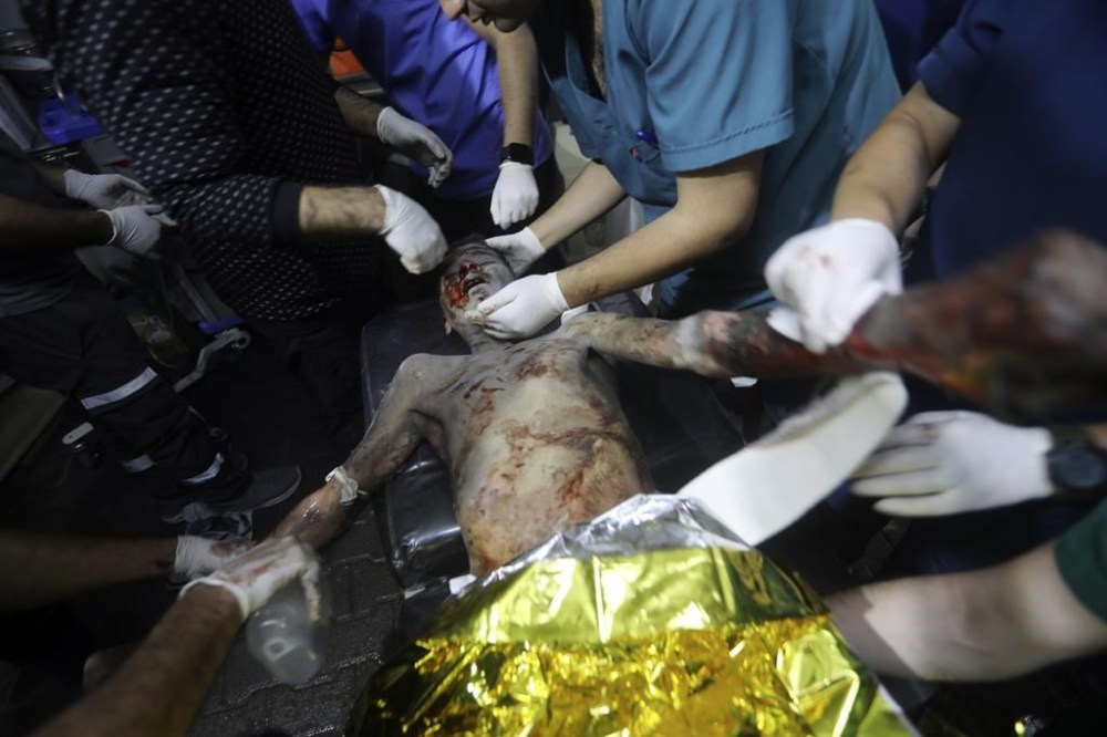 EDS NOTE: GRAPHIC CONTENT - Palestinian medics treat a boy seriously wounded in the Israeli bombardment of the Gaza Strip at the Kuwaiti Hospital in Rafah refugee camp, southern Gaza Strip, early Friday, May 3, 2024. (AP Photo/Ismael Abu Dayyah)