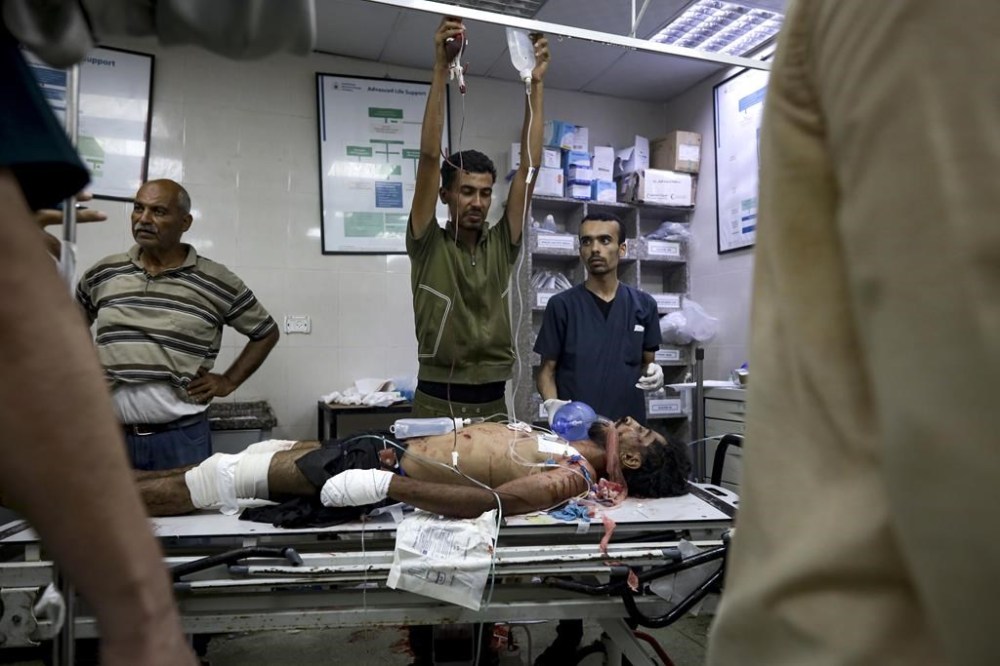 A Palestinian man wounded in the Israeli bombardment of the Gaza Strip is treated in a hospital in Khan Younis, Tuesday, July 9, 2024. (AP Photo/Jehad Alshrafi)