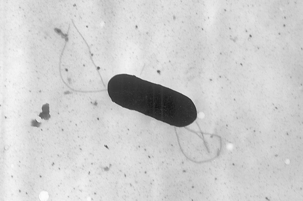 Ontario's Health Ministry has confirmed that the two listeriosis deaths linked to a plant-based milk recall were in that province. An electron microscope image made available by the Centers for Disease Control and Prevention shows a Listeria monocytogenes bacterium in a 2002 handout photo. THE CANADIAN PRESS/AP-HO, CDC, Elizabeth White, *MANDATORY CREDIT*
