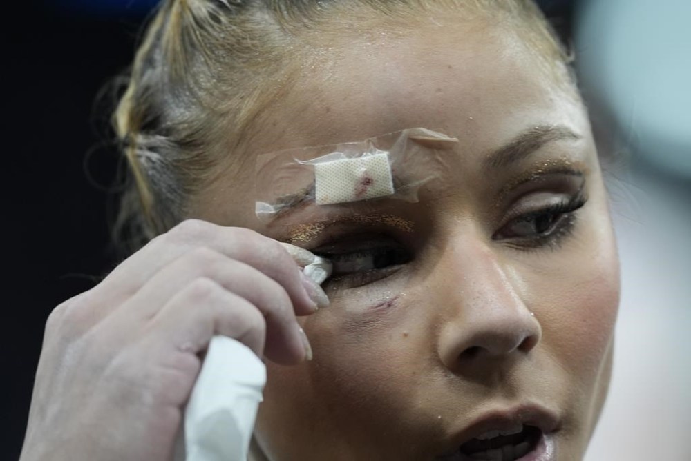 Flavia Saraiva, of Brazil, has an injury after falling during a warm up during the women's artistic gymnastics team finals round at Bercy Arena at the 2024 Summer Olympics, Tuesday, July 30, 2024, in Paris, France. (AP Photo/Francisco Seco)