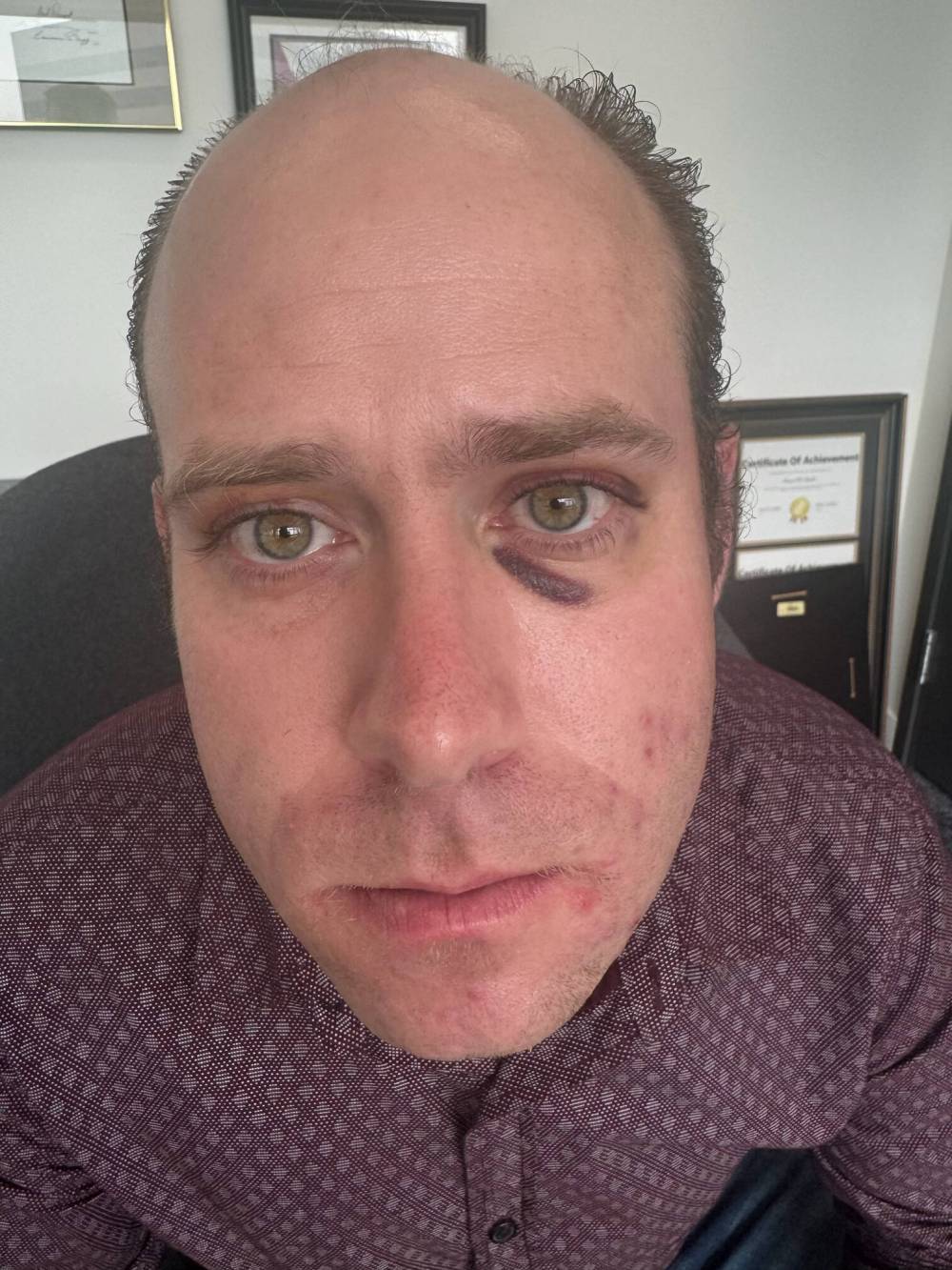 SUPPLIED
Scott Joseph Taylor was attacked on the street after police wrongly identified him as a suspect in a child sex ring.