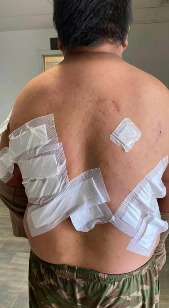 Waylon Thomas in the aftermath of a bear attack. (Supplied)