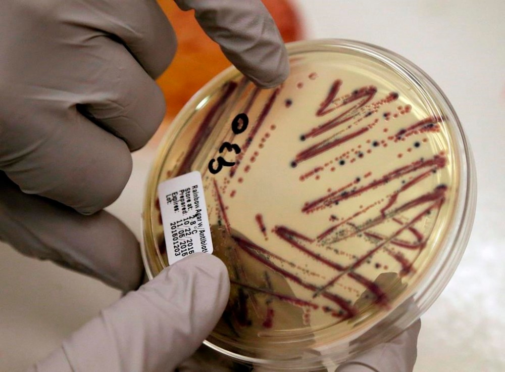 A daycare in central Alberta has been temporarily shut down due to an E. coli outbreak. A microbiologist points out an isolated E. coli growth on an agar plate from a patient specimen at the Washington State Dept. of Health, in Shoreline, Wash., Tuesday, Nov. 3, 2015. THE CANADIAN PRESS/AP-Elaine Thompson