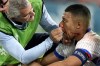FILE - Kylian Mbappe of France receives a treatment after suffering an injury during a Group D match between Austria and France at the Euro 2024 soccer tournament in Duesseldorf, Germany, on June 17, 2024. (AP Photo/Alessandra Tarantino, File)
