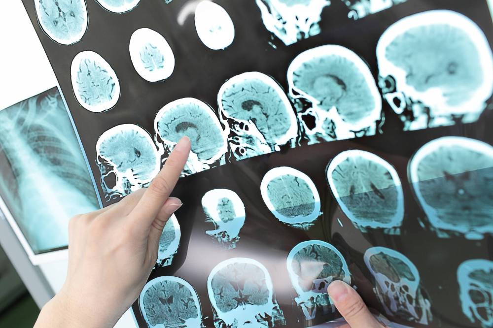 Sudok1/Dreamstime/TNS
The health care system involves hundreds of interconnected parts, all of which have to be considered when making changes.