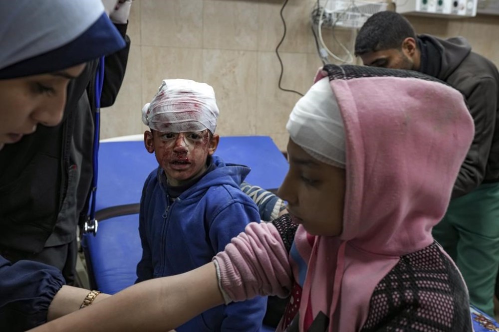 Palestinian children wounded during the Israeli bombardment of the Gaza Strip receive treatment at the Al-Aqsa Hospital in Deir al-Balah, Tuesday, Jan. 14, 2025. (AP Photo/Abdel Kareem Hana)