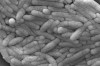 This 2009 electron microscope image provided by the Centers for Disease Control and Prevention shows a large group of Gram-negative Salmonella typhimurium bacteria that had been isolated from a pure culture. THE CANADIAN PRESS/AP, CDC - Janice Haney Carr