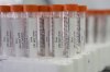 Vials containing PFAS samples sit in a tray at a U.S. Environmental Protection Agency lab in Cincinnati, April 10, 2024. THE CANADIAN PRESS/AP-Joshua A. Bickel