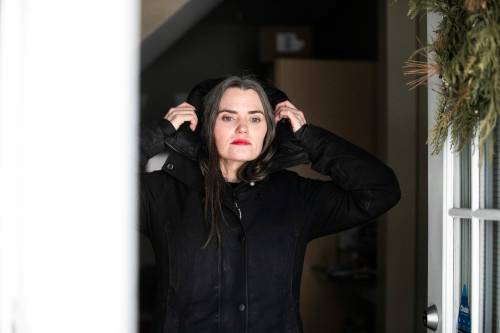 MIKAELA MACKENZIE / FREE PRESS
                                Lisa Moore’s cold urticaria symptoms are triggered by cold water or extremely low temperatures.