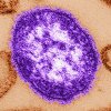 A measles virus particle, centre, is shown in an undated handout image. THE CANADIAN PRESS/AP-Cynthia Goldsmith/Centers for Disease Control and Prevention, *MANDATORY CREDIT*