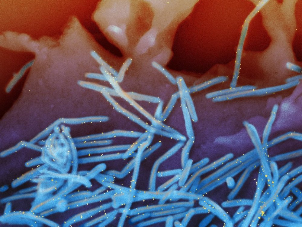 FILE - This electron microscope image provided by the National Institutes of Health shows human respiratory syncytial virus (RSV) virions, colorized blue, and anti-RSV F protein/gold antibodies, colorized yellow, shedding from the surface of human lung cells. (National Institute of Allergy and Infectious Diseases, NIH via AP, File)