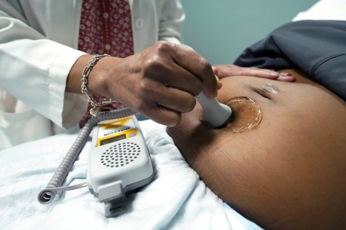 A doctor uses a hand-held Doppler probe on a pregnant woman to measure the heartbeat of the fetus, Dec. 17, 2021, in Jackson, Miss. THE CANADIAN PRESS/AP-Rogelio V. Solis
