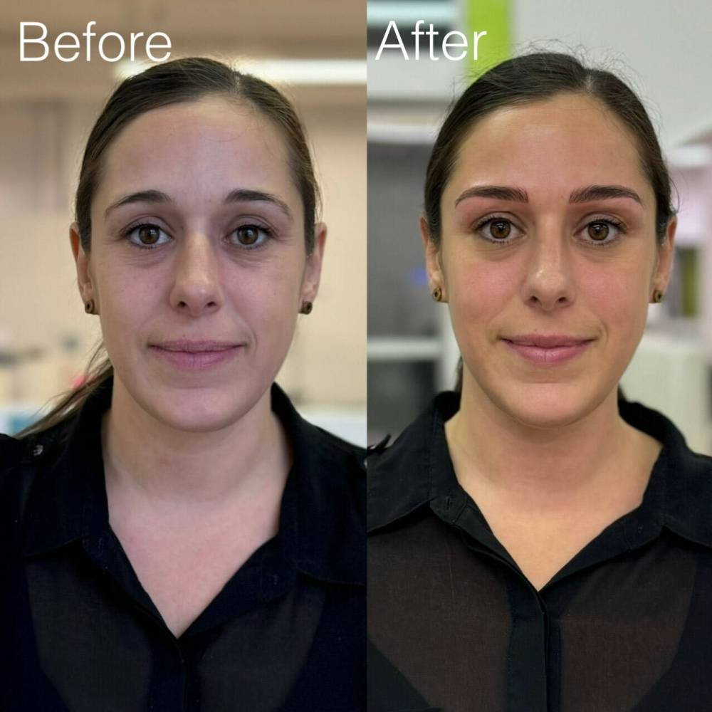 KIANA DELOS SANTOS PHOTO
                                Nano brows are created using a thin needle to create individual hair strokes.