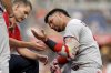 St. Louis Cardinals' Willson Contreras, right, is examined by a team trainer after getting hit by a pitch by Pittsburgh Pirates pitcher Paul Skenes during the fourth inning of a baseball game, Tuesday, July 1, 2025, in Pittsburgh. (AP Photo/Matt Freed)