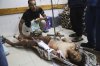 A Palestinian man who was injured at an aid distribution center run by the Gaza Humanitarian Foundation, a U.S.-backed organization approved by Israel, receives treatment on the floor of Nasser Hospital in Khan Younis, southern Gaza Strip, Saturday, July 19, 2025. (AP Photo/Mariam Dagga)