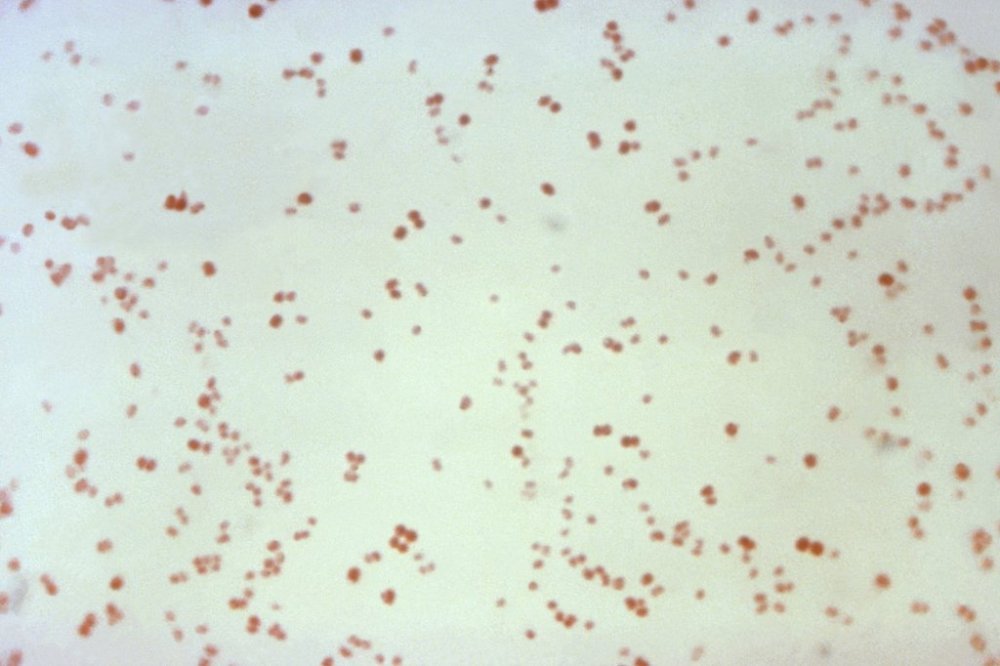 FILE - This 1971 microscope photo provided by the Centers for Disease Control and Prevention shows Neisseria gonorrhoeae bacteria, which causes the sexually-transmitted disease gonorrhea. (CDC via AP, File)