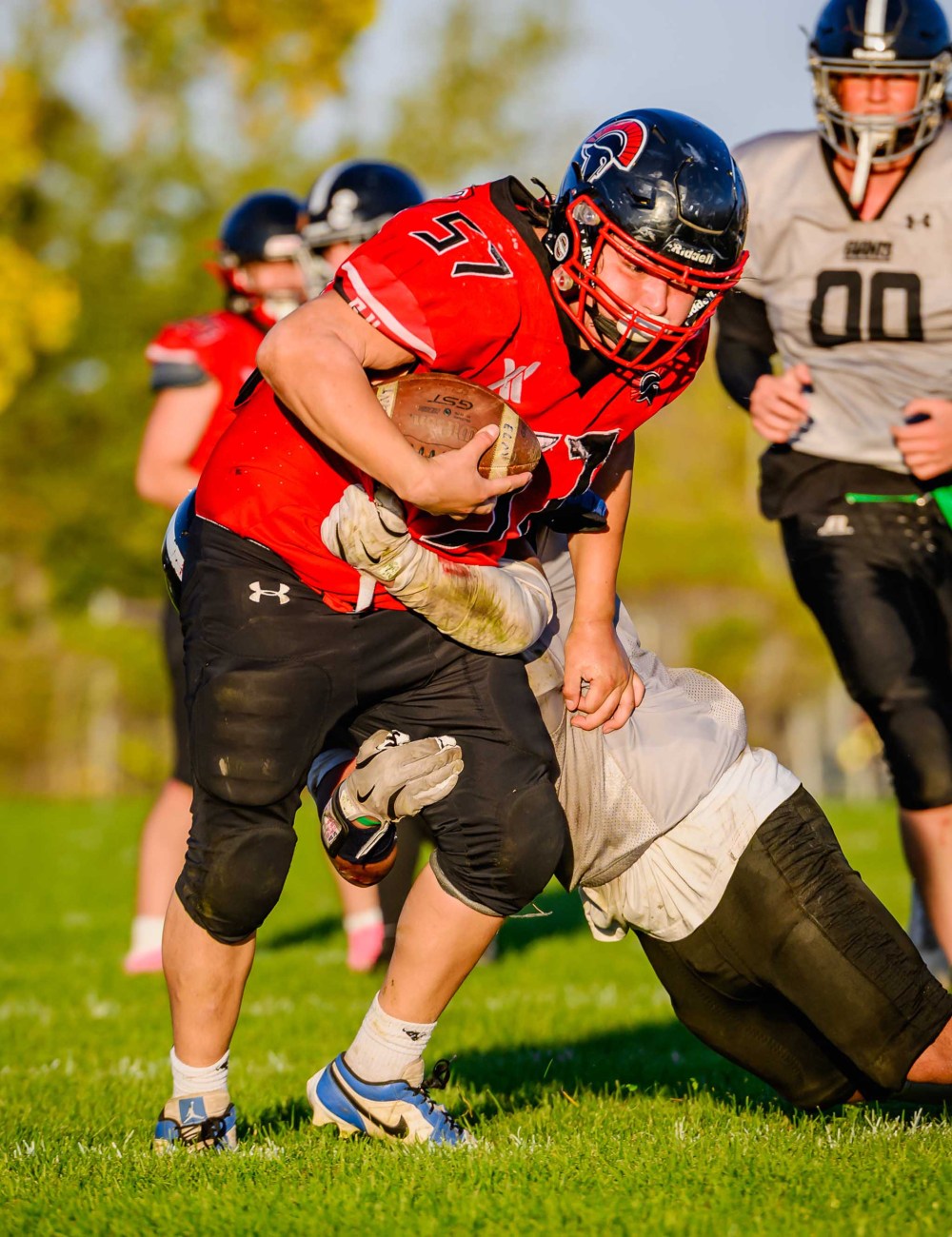 DGN PHOTOS
                                Doctors believed Hartshorne would be paralyzed from the neck down following surgery, but that proved to be the least of their concerns.