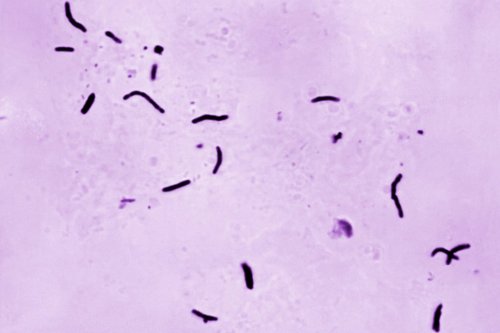 FILE - This 1966 microscope photo provided by the U.S. Centers for Disease Control and Prevention shows Mycobacterium tuberculosis bacilli, the organism responsible for causing the disease tuberculosis. (Elizabeth S. Mingioli/CDC via AP, File)