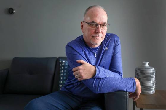 Nearly a year after he was severely hurt in an explosion while vacationing in Hawaii, Darren Stevenson has lasting scars. (Ruth Bonneville / Free Press)