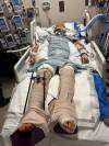 SUPPLIED Winnipeg resident Darren Stevenson, 59, was severely injured in a suspected barbecue gas explosion while on vacation with his wife, Diane, in Maui.