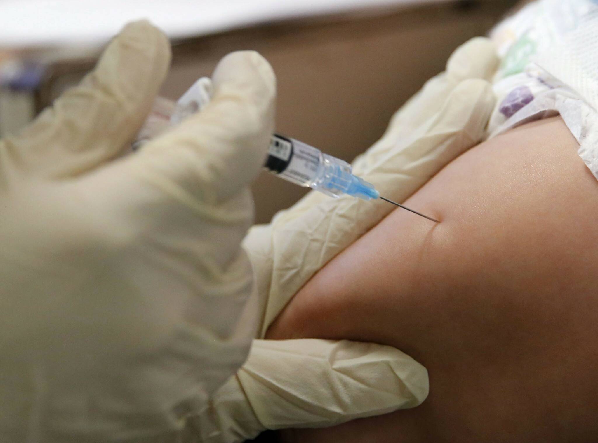 Manitoba has most measles cases in Canada — and it’s likely much worse, doctors say