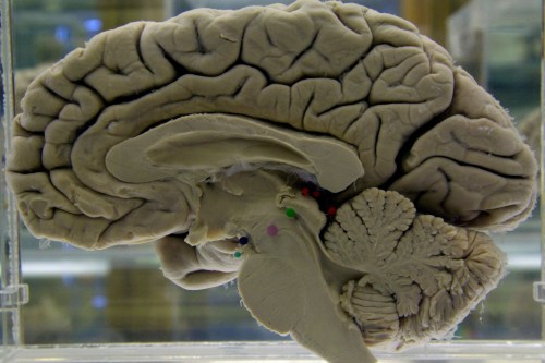 FILE - A section of a preserved human brain on display at the Museum of Neuroanatomy at the University at Buffalo, in Buffalo, N.Y., on Tuesday, Oct. 7, 2003. (AP Photo/David Duprey, File)
